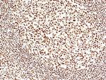 SMARCB1 Antibody in Immunohistochemistry (Paraffin) (IHC (P))