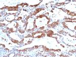 FAK Antibody in Immunohistochemistry (Paraffin) (IHC (P))