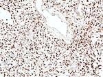 STAT6 Antibody in Immunohistochemistry (Paraffin) (IHC (P))