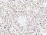 STAT6 Antibody in Immunohistochemistry (Paraffin) (IHC (P))