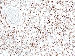 STAT6 Recombinant Rabbit Monoclonal Antibody (RM473)