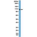 STAT6 Antibody in Western Blot (WB)
