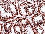 MSH2 Antibody in Immunohistochemistry (Paraffin) (IHC (P))