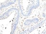 MSH2 Recombinant Rabbit Monoclonal Antibody (RM478)