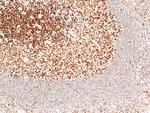 MSH2 Antibody in Immunohistochemistry (Paraffin) (IHC (P))