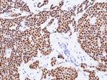 GATA3 Antibody in Immunohistochemistry (Paraffin) (IHC (P))