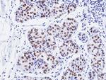 GATA3 Antibody in Immunohistochemistry (Paraffin) (IHC (P))