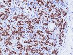 GATA3 Antibody in Immunohistochemistry (Paraffin) (IHC (P))