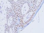 GATA3 Antibody in Immunohistochemistry (Paraffin) (IHC (P))
