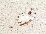 Carbonic Anhydrase IX Antibody in Immunohistochemistry (Paraffin) (IHC (P))