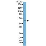 Carbonic Anhydrase IX Antibody in Western Blot (WB)