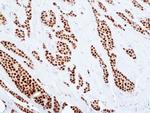 Estrogen Receptor alpha Recombinant Rabbit Monoclonal Antibody (RM494)