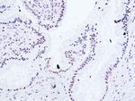 Estrogen Receptor alpha Antibody in Immunohistochemistry (Paraffin) (IHC (P))