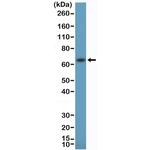 Estrogen Receptor alpha Antibody in Western Blot (WB)