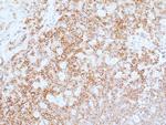 CD45 Antibody in Immunohistochemistry (Paraffin) (IHC (P))