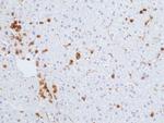 CD45 Antibody in Immunohistochemistry (Paraffin) (IHC (P))