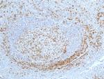 CD27 Antibody in Immunohistochemistry (Paraffin) (IHC (P))