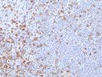 CD27 Antibody in Immunohistochemistry (Paraffin) (IHC (P))