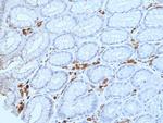 CD27 Antibody in Immunohistochemistry (Paraffin) (IHC (P))