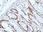 DNA-PK Antibody in Immunohistochemistry (Paraffin) (IHC (P))