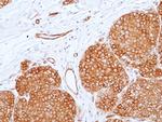 CD155 Antibody in Immunohistochemistry (Paraffin) (IHC (P))