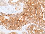CD155 Antibody in Immunohistochemistry (Paraffin) (IHC (P))