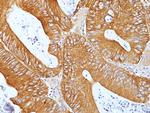 CD155 Antibody in Immunohistochemistry (Paraffin) (IHC (P))