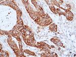 CD155 Recombinant Rabbit Monoclonal Antibody (RM514)