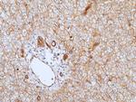 CD155 Antibody in Immunohistochemistry (Paraffin) (IHC (P))