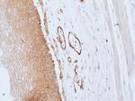 CD155 Antibody in Immunohistochemistry (Paraffin) (IHC (P))