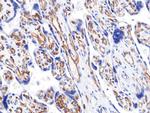 VEGF Receptor 2 Antibody in Immunohistochemistry (Paraffin) (IHC (P))