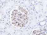 VEGF Receptor 2 Antibody in Immunohistochemistry (Paraffin) (IHC (P))