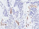 VEGF Receptor 2 Antibody in Immunohistochemistry (Paraffin) (IHC (P))