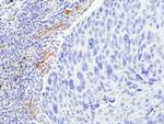 VEGF Receptor 2 Antibody in Immunohistochemistry (Paraffin) (IHC (P))
