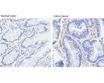 VEGF Receptor 2 Antibody in Immunohistochemistry (Paraffin) (IHC (P))