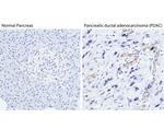 VEGF Receptor 2 Antibody in Immunohistochemistry (Paraffin) (IHC (P))