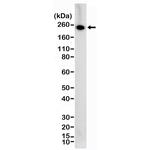 VEGF Receptor 2 Antibody in Western Blot (WB)