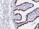 WT1 Antibody in Immunohistochemistry (Paraffin) (IHC (P))