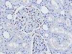 WT1 Antibody in Immunohistochemistry (Paraffin) (IHC (P))