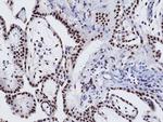 WT1 Antibody in Immunohistochemistry (Paraffin) (IHC (P))