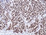 WT1 Antibody in Immunohistochemistry (Paraffin) (IHC (P))