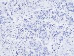 WT1 Antibody in Immunohistochemistry (Paraffin) (IHC (P))