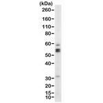 WT1 Antibody in Western Blot (WB)
