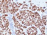 TRPS1 Antibody in Immunohistochemistry (Paraffin) (IHC (P))