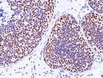 TRPS1 Antibody in Immunohistochemistry (Paraffin) (IHC (P))