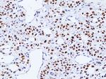 TRPS1 Recombinant Rabbit Monoclonal Antibody (RM518)