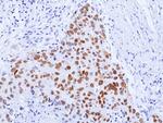 TRPS1 Antibody in Immunohistochemistry (Paraffin) (IHC (P))