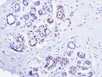 TRPS1 Antibody in Immunohistochemistry (Paraffin) (IHC (P))