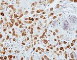 Mammaglobin A Antibody in Immunohistochemistry (Paraffin) (IHC (P))