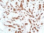 Phospho-GSK3B (Ser9) Antibody in Immunohistochemistry (Paraffin) (IHC (P))